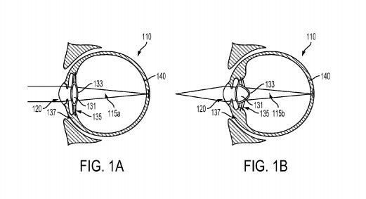 Google патентует устройство, которое будет вводиться в глазное яблоко